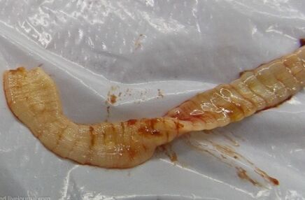 Parasiten im Körper